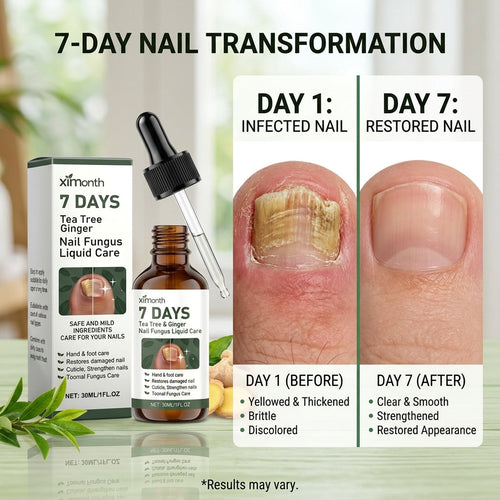 ToeFix